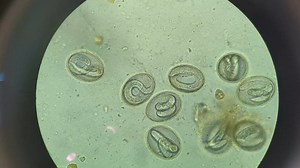Fecal sample 😲🔬❤️. | Lab life