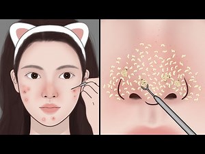 Satisfying Relaxation~ ASMR Blackhead Removal, Blackhead extraction | Meng's Stop Motion