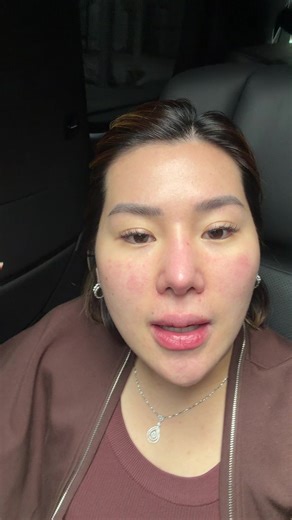 Understanding Hypochlorous Acid for Acne Treatment