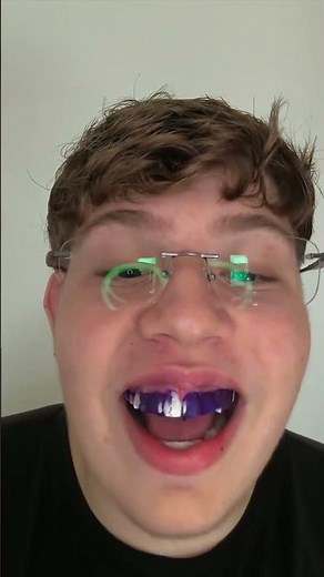 Fita Clareadora Dental Roxa! Que LOUCURA É ESSA?