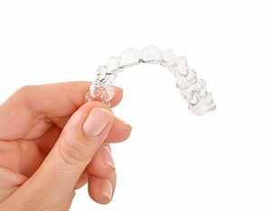 iGO(インビザライン・ゴー)システム | アネラデンタルクリニック・矯正歯科