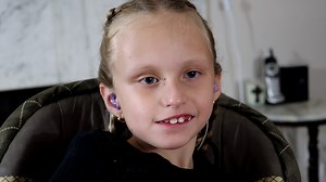 167K views · 3.3K reactions | Jocelyn was diagnosed with congenital CMV shortly after birth. This common virus infected her brain before her immune system developed. As a result, today Jocelyn is diagnosed with autism, cerebral palsy, hearing and vision loss. Jocelyn's family wants others to know that congenital CMV exists and it is possible to prevent further damage if diagnosed within the first 6 months. | Special Books by Special Kids | Facebook