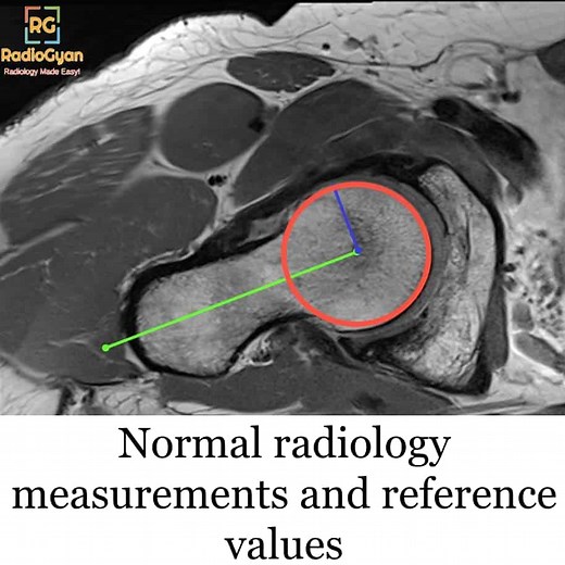 Normal radiology measurements and reference values (2020) | Radiogyan