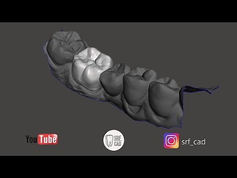 MESHMIXER DENTAL : Tutorial come creare un provvisorio temporary C&B