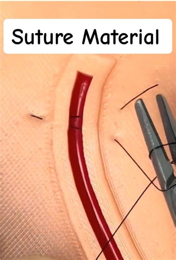 Surgical Suture Materials 😷 #medicaltiktok #veterinariansoftiktok #doctorsoftiktok #suturing #surgeonsoftiktok @THE SUTURE BUDDY