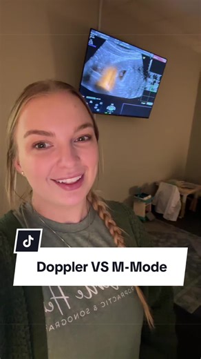 Understanding Early Pregnancy Heartbeat Scans