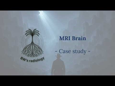 MRI Brain - Approach to hematogeneous and leptomeningeal metastasis