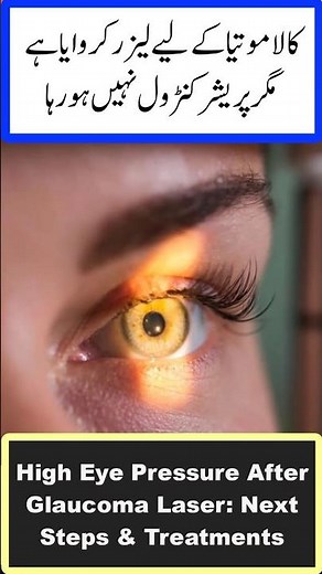 High Eye Pressure After Glaucoma Laser: Next Steps & Treatments