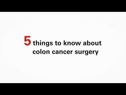 5 things to know about colon cancer surgery
