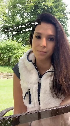 Understanding Mamelons on Teeth