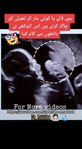 Ultra doppler Ultrasounds of Foetus in Woomb #bestdoctor #pediatrician #hospital #gynaecologist #the_pulse_medical_complex
