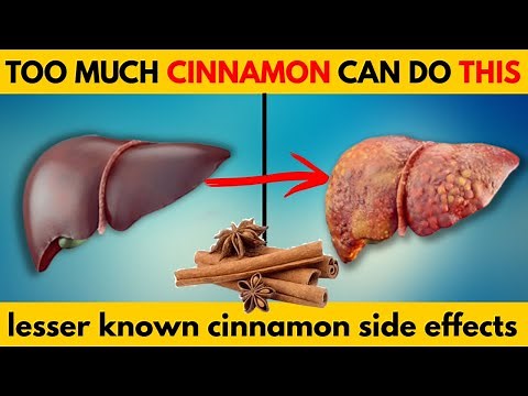6 Lesser Known Side Effects of Cinnamon