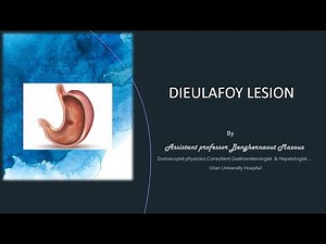 DIEULAFOY LESION