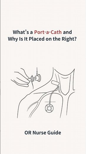 Port a cath #operatingroom #portacath #ornurseguide