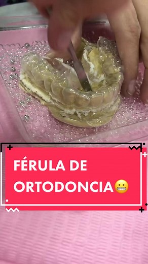 FÉRULA DE ORTODONCIA😬, es una plaquita de uso diario luego del tratamiento de ortodoncia con el fin de que los dientes no vuelvan a su estado original debido a que LOS DIENTES TIENEN MEMORIAAA!😰#dientes #memoria #ferula #placa #ortodoncia #odontologia #movimientodental #pasoapaso #procesoenvivo #procedimiento #placa #acetato #vacum #estudiantesdeosontologia #odontolove #ortodoncia #viral #parati #fyp