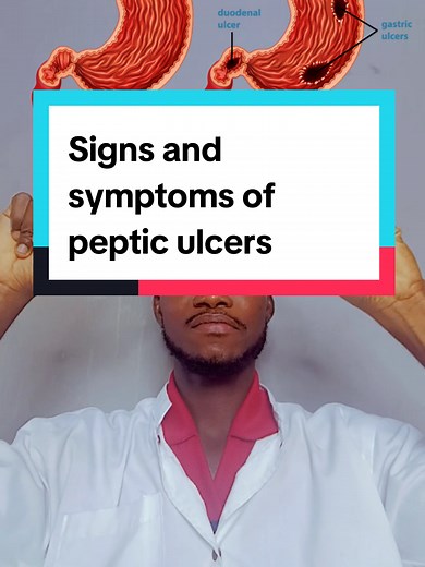 Understanding Signs of Peptic Ulcers and Their Symptoms