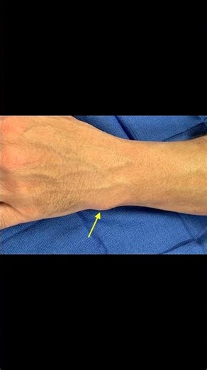 Ulnocarpal Joint Explained 🦴 #anatomy #wristpain #ortho #meded #medicaleducation #ATC #physio