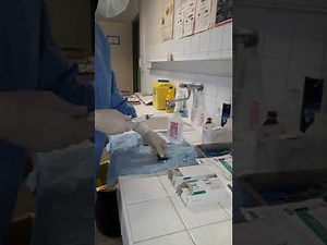 Intravesical instillation with mitomycin C