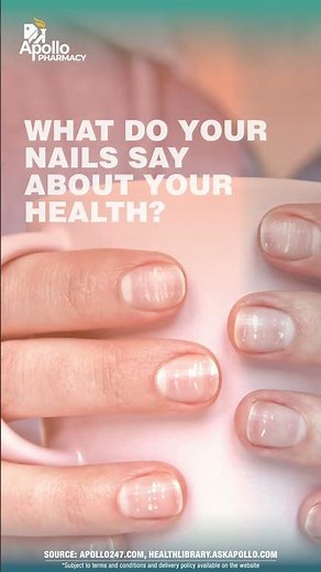 What Your Nails Say About Your Health!