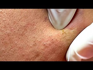 Relax Every Day With Mun Spa #25