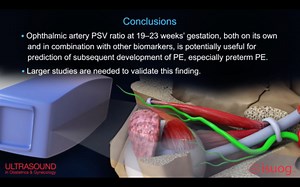 UOG video abstract: Ophthalmic artery Doppler in combination with other biomarkers in prediction of pre-eclampsia at 19–23 weeks’ gestation