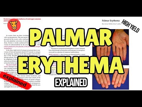 PALMAR ERYTHEMA Pathogenesis of Signs and Symptoms