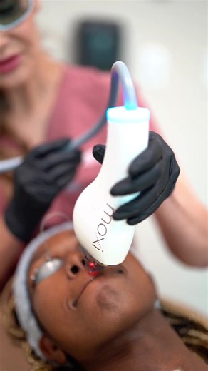 Now is the time to get your laser treatments in before the summer months ☀️ Laser treatments are best done when sun exposure is limited, making winter early spring prime “laser season”⚡ At CFPS, our lasers can target: • Sun damage & brown spots • Redness & rosacea • Acne & acne scarring • Texture & pore size • Fine lines & overall skin rejuvenation Every guest starts with a consultation imaging so we can build a personalized laser plan. Head to our stories to see real before & afters and learn w