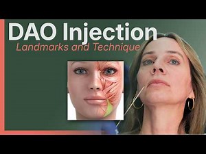 How to Inject the DAO (Without Hitting the DLI) | Neurotoxin Training