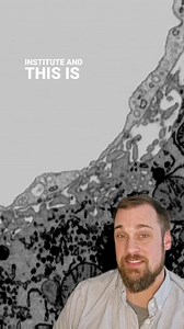 In this video, you can see two cell types within the liver. The blue cell is a hepatic endothelial cell which are the cells that line the blood vessels that run through the liver. The yellow cells are hepatocytes which are common liver cells that help it to carry out its function like detoxifying the bloodstream, producing hormones, and other molecules, that go back into the bloodstream and circulate throughout the body. The green tube-like structures that run through both cells are the endoplas