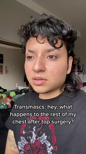 Understanding Post-Top Surgery Care for Transmasculine Individuals