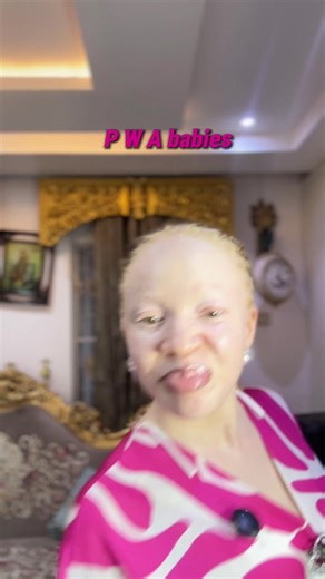 Essential Skincare Tips for Children with Albinism