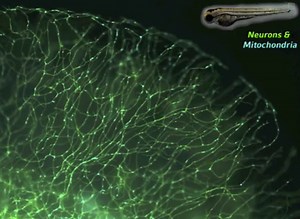 Time lapse movie of transport of mitochondria in nerve cells of transgenic zebrafish | 2011 Small World In Motion Competition
