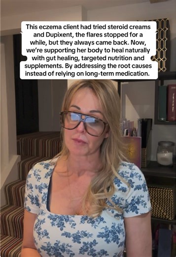 Natural Healing for Eczema: Beyond Steroid Treatments