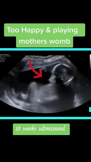 18 Weeks Baby Ultrasound Scan