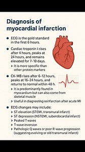 367K views · 2.4K reactions | Diagnosis of myocardial infarction ( MI) #heart #medicalstudent #MedG #fblifestyle | Med G | Facebook