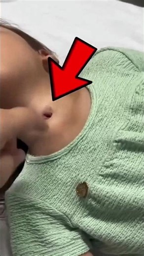 She Breathes Through a Hole in Her Neck |Tracheostomy |Born Different Shorts