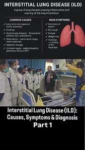 #drs #nursing “Interstitial Lung Disease (ILD) is a serious condition where lung tissue becomes inflamed and stiff, leading to breathlessness and dry cough. Early diagnosis and proper treatment can slow progression. Stay aware, stay healthy.”#ILD #LungDisease #MedicalEducation #HealthAwareness #respiratorycare | Sanjay singh