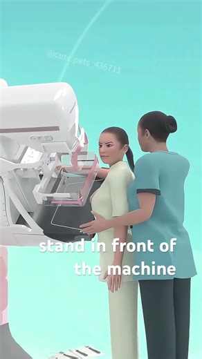 Mammogram or mammography procedure (3D Animation) #cancer #cancerdiagnosis #cancercure