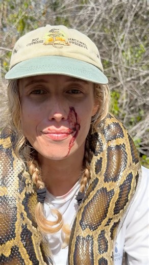 Bitten on the face by a 13-foot python in the Florida Everglades