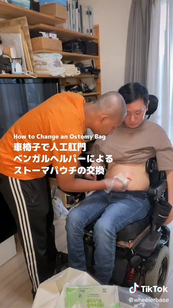 これができるようになると本当に心強い。#頸髄損傷 #ベンガルヘルパー #ostomybag #stoma