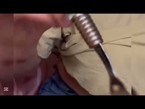 STUFFING AND BURPING