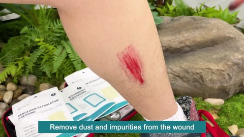 Ceeport Medical Xeroform Petrolatum Dressing 5x9 - Non-Adherent Gauze Pad Strip, Fine Mesh Gauze Patch Supplies for Wound Care, Burns, Lacerations, & Skin Grafts (Pack of 25)