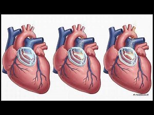 A Pacemaker That Disappears? The Biotech Revolution from Northwestern