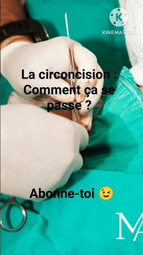 La circoncision bébé. #shorts #pourtoi #tiktok #motivation