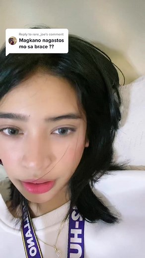 Braces Price Guide in the Philippines: Cost, Payment Options & More