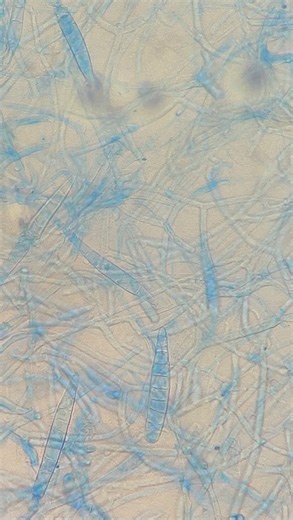 Zibeyda Gambarova | MD on Instagram: "Microsporum canis on SDA This zoophilic dermatophyte (infecting animals and humans) causes infections of scalp (tinea capitis) and skin (tinea corporis)."