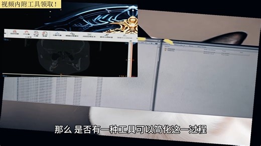 dicom阅读器？radiantviewer破解版？医学软件app排行榜？