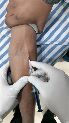 One Shot – Perfect Vein Access 💉 | Real Clinical Skill