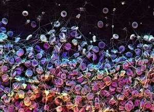 Bioinspired coating for medical devices repels blood and bacteria