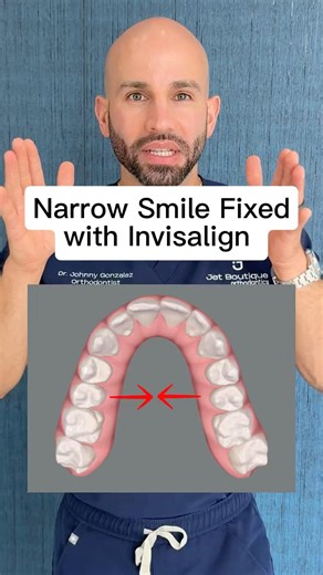 Can Invisalign Widen a Narrow Smile and Fix Crowded Teeth